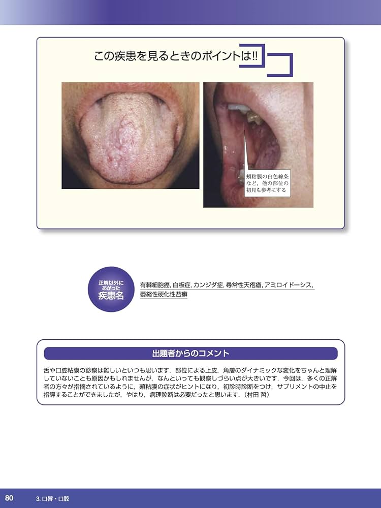 臨床力が高まる皮膚科診断クイズあなたの診断は? 上 Amazon.co.jp: 臨床力が高まる皮膚科診断クイズ 上 : 江藤隆史